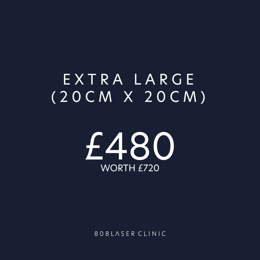 Extra Large (20cm x 20cm)